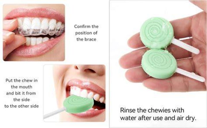 Are chewies necessary for Invisalign?