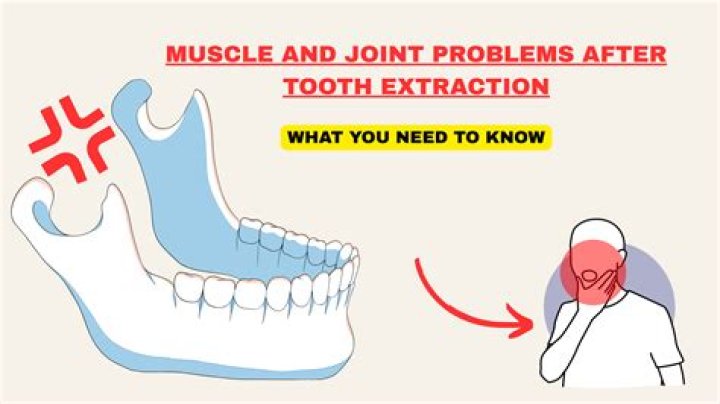 Can a tooth extraction cause a broken jaw?