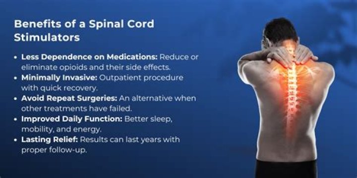 Do spinal stimulators work?