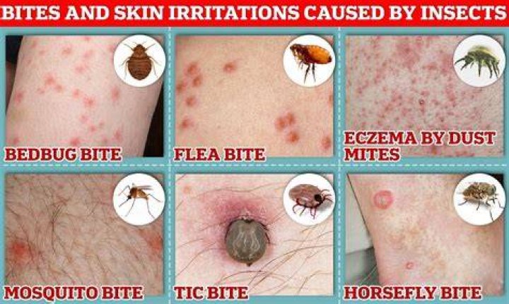 How do you keep bugs off your skin?