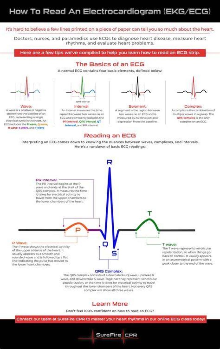 How do you read a fetal EKG?