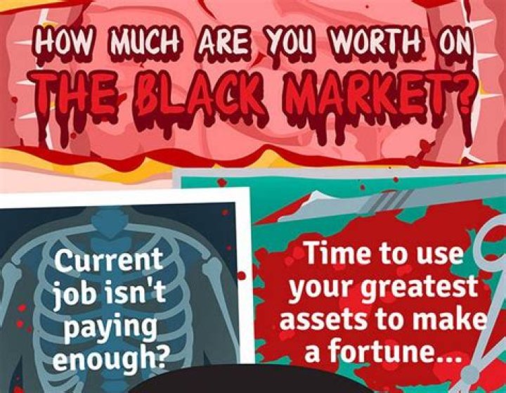 How much are the black keys worth?
