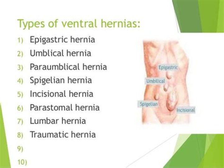 What is the difference between ventral and umbilical hernia?